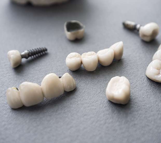 Flemington The Difference Between Dental Implants and Mini Dental Implants