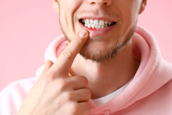 Reasons To Choose Periodontics