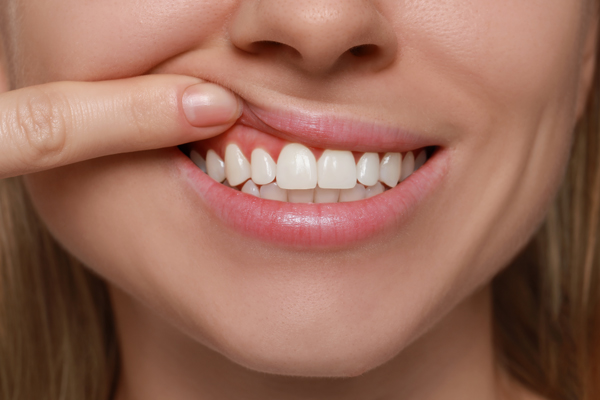 Smile Makeover Options For Damaged Teeth